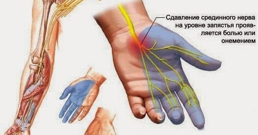 Мениск колена где лечат